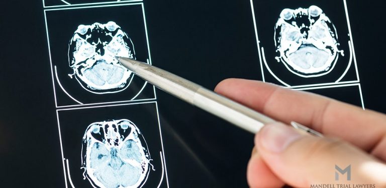 brain and head injuries 1024x500 1 768x375